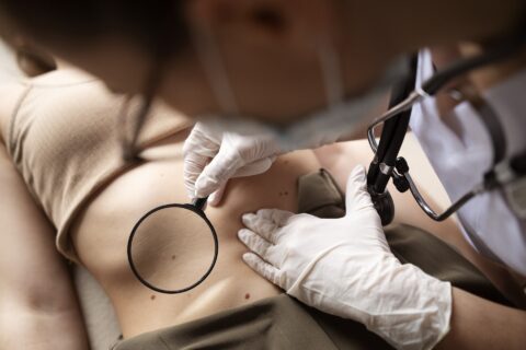 Skin Lesion Removal